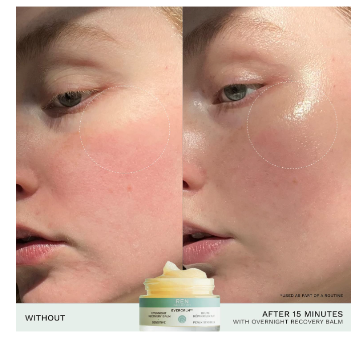 REN Clean Skincare Evercalm Overnight Recovery Balm 30ml