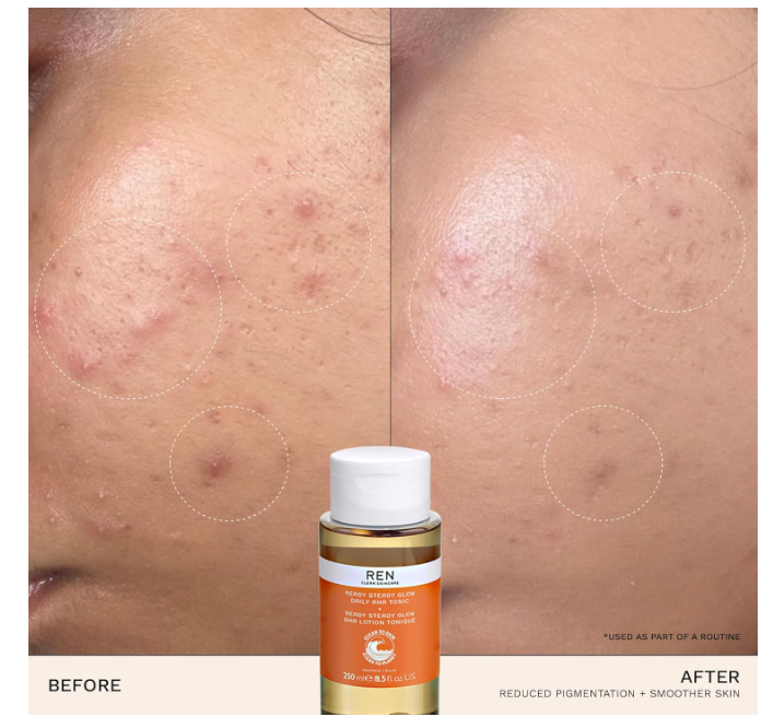 REN Clean Skincare Ready Steady Glow Daily AHA Tonic