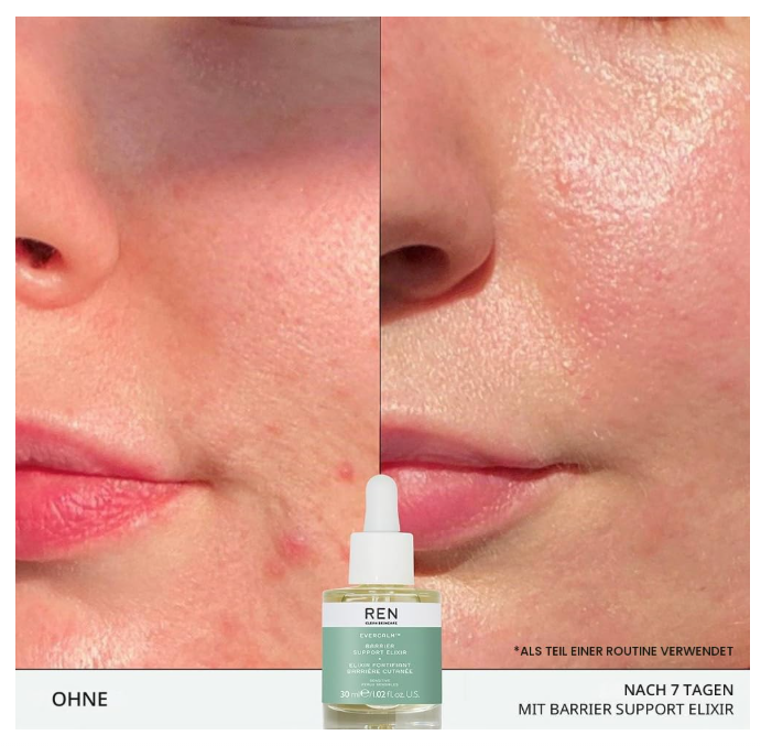 REN Clean Skincare Evercalm Barrier Support Elixir 30ml