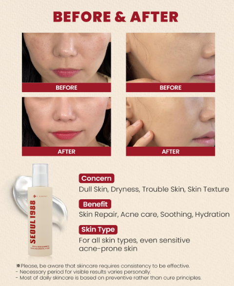 K-Secret Seoul 1988 Essence Snail Mucin 97% + Rice