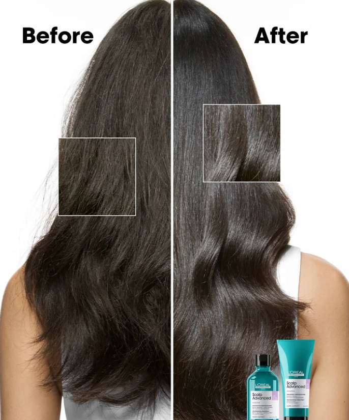 L'Oréal Professionnel Scalp Advanced Niacinamide Shampoo 300ml
