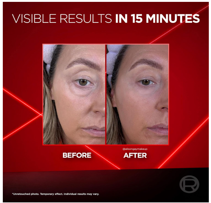 L'Oréal Paris Revitalift Eye Bag Instant Eraser 15ml