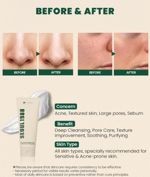 K-Secret Seoul 1988 Cleansing Foam Pine Cica 1% + Probiotics 150ml